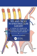 Bild: Tips and Tricks in Endovascular Surgery - CRC Press