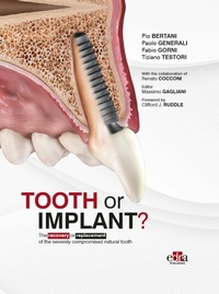 Enlarge image Cover: Tooth or Implant? - EDRA Publications LLC