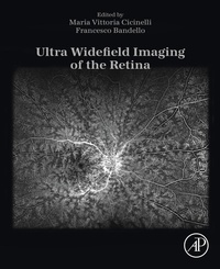 Abbildung von: Ultra Widefield Imaging of the Retina - Elsevier