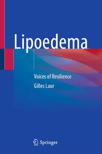 Abbildung von: Lipoedema - Springer