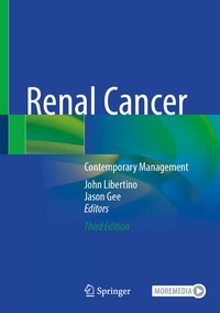 Abbildung von: Renal Cancer - Springer