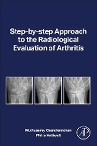 Enlarge image Cover: Step-by-step Approach to the Radiological Evaluation of Arthritis - Academic Press