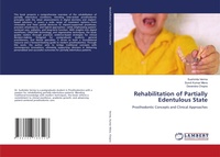Abbildung von: Rehabilitation of Partially Edentulous State - LAP Lambert Academic Publishing