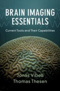 Abbildung von: Brain Imaging Essentials - Cambridge University Press
