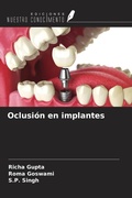Cover: Oclusi&oacute;n en implantes - Ediciones Nuestro Conocimiento