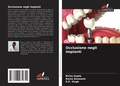 Cover: Occlusione negli impianti - Edizioni Sapienza