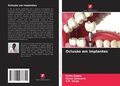 Cover: Oclusao em implantes - Edicoes Nosso Conhecimento