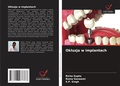 Cover: Okluzja w implantach - Wydawnictwo Nasza Wiedza