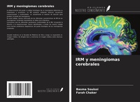 Abbildung von: IRM y meningiomas cerebrales - Ediciones Nuestro Conocimiento