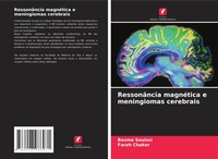 Abbildung von: Ressonancia magnetica e meningiomas cerebrais - Edicoes Nosso Conhecimento