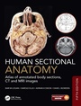 Cover: Human Sectional Anatomy - CRC Press
