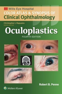 Abbildung von: Oculoplastics - Wolters Kluwer Health