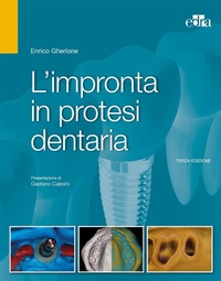 Abbildung von: L' impronta in protesi dentaria - Edra