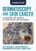 Cover: Dermatoscopy and Skin Cancer, second edition - Scion Publishing Ltd