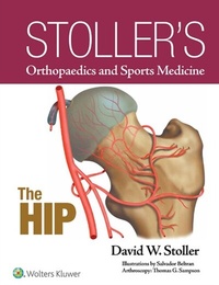 Abbildung von: Stoller's Orthopaedics and Sports Medicine: The Hip - WOLTERS KLUWER HEALTH