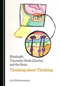 Abbildung von: Blindsight, Traumatic Brain Injuries, and the Brain - Cambridge Scholars Publishing