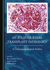 Abbildung von: Atlas of Renal Transplant Pathology - Cambridge Scholars Publishing