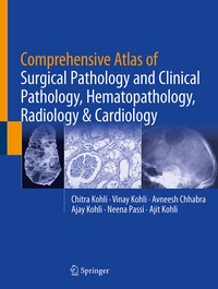Abbildung von: Comprehensive Atlas of Surgical Pathology and Clinical Pathology, Hematopathology, Radiology & Cardiology - Springer