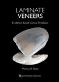 Cover: Laminate Veneers - Quintessence Publishing Co. Ltd.