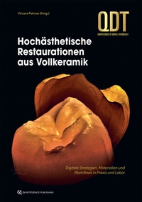 Abbildung von: Hochästhetische Restaurationen aus Vollkeramik - Quintessenz Verlag