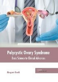 Enlarge image Cover: Polycystic Ovary Syndrome: Basic Science to Clinical Advances - HAYLE MEDICAL