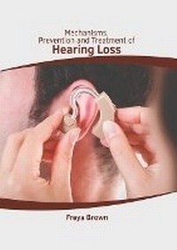 Abbildung von: Mechanisms, Prevention and Treatment of Hearing Loss - HAYLE MEDICAL