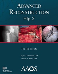 Abbildung von: Advanced Reconstruction: Hip 2 - WOLTERS KLUWER HEALTH