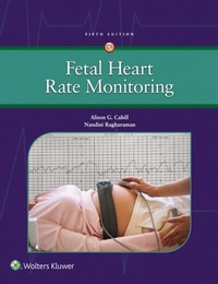 Abbildung von: Fetal Heart Rate Monitoring - WOLTERS KLUWER HEALTH