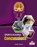 Cover: Concussions - Crabtree Forest