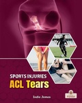 Cover: ACL Tears - Crabtree Forest