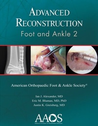 Abbildung von: Advanced Reconstruction: Foot and Ankle 2 - WOLTERS KLUWER HEALTH