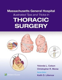 Abbildung von: Massachusetts General Hospital Illustrated Tips and Tricks in Thoracic Surgery - WOLTERS KLUWER HEALTH