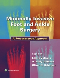 Abbildung von: Minimally Invasive Foot and Ankle Surgery - WOLTERS KLUWER HEALTH