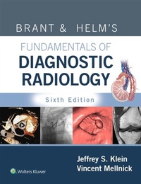 Abbildung von: Brant & Helm's Fundamentals of Diagnostic Radiology - WOLTERS KLUWER HEALTH