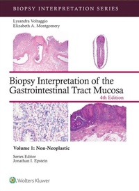 Abbildung von: Biopsy Interpretation of the Gastrointestinal Tract Mucosa Volume 1 - WOLTERS KLUWER HEALTH