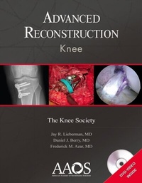 Abbildung von: Advanced Reconstruction: Knee - WOLTERS KLUWER HEALTH