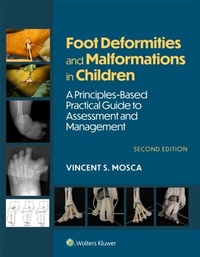 Abbildung von: Foot Deformities and Malformations in Children - WOLTERS KLUWER HEALTH