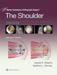 Abbildung von: Master Techniques in Orthopaedic Surgery: The Shoulder - WOLTERS KLUWER HEALTH