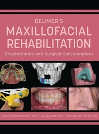 Abbildung von: Beumer's Maxillofacial Rehabilitation - Foundation for Oral-Facial Rehabilitation