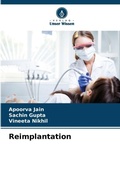 Cover: Reimplantation - Verlag Unser Wissen