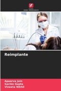 Cover: Reimplante - Edicoes Nosso Conhecimento