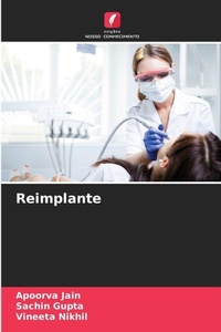 Enlarge image Cover: Reimplante - Edicoes Nosso Conhecimento