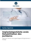 Cover: Implantatgestuetzte orale Rehabilitation des Jochbeins - Verlag Unser Wissen