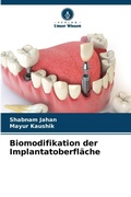 Cover: Biomodifikation der Implantatoberflaeche - Verlag Unser Wissen