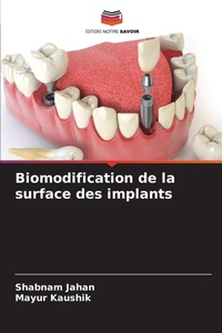 Enlarge image Cover: Biomodification de la surface des implants - Editions Notre Savoir