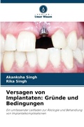 Cover: Versagen von Implantaten - Verlag Unser Wissen
