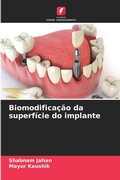 Cover: Biomodificacao da superficie do implante - Edicoes Nosso Conhecimento