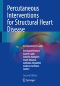 Bild: Percutaneous Interventions for Structural Heart Disease - Springer