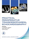 Bild: Practical Perioperative Transoesophageal Echocardiography - Oxford University Press