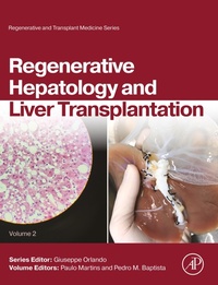 Abbildung von: Regenerative Hepatology and Liver Transplantation - Elsevier